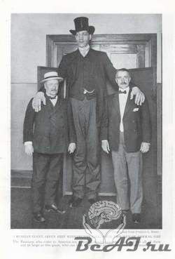 130 лет со дня самого высокого в мире человека