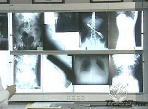 Удивительные рентгеновские снимки